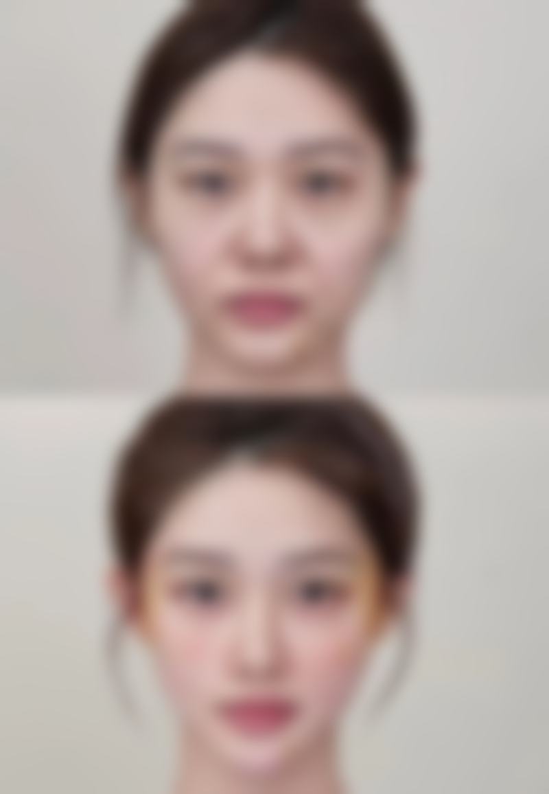 服务流程与患者保护——全程贴心,无忧变得更美