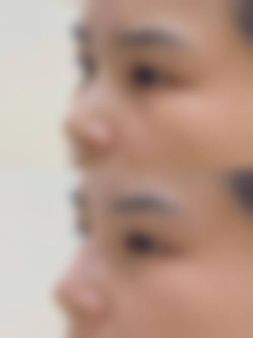四、韩国 Reageau 首尔皮肤科特色项目