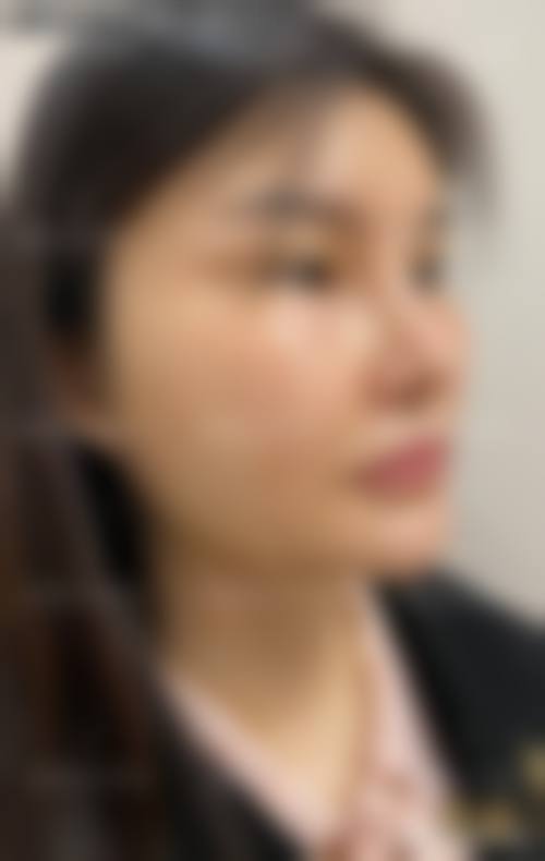 六、韩国 Reageau 首尔皮肤科价格表