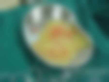 二、杨松林擅长项目
