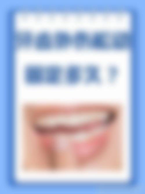 优惠活动详情：限时特别优惠与预约补贴