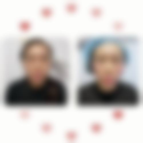 三、北京品极激光皮肤养护中 心诊疗项目有哪些?