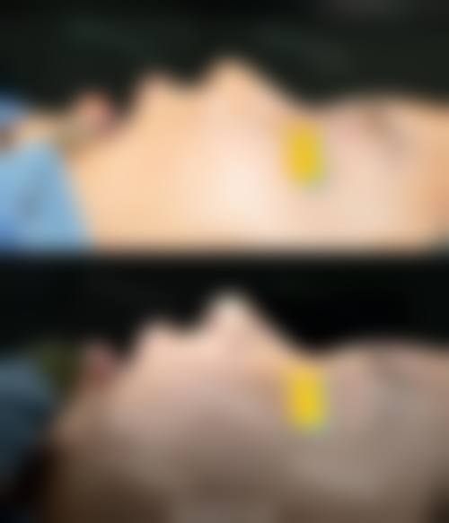 优惠活动详情:限时特别优惠,到院即享