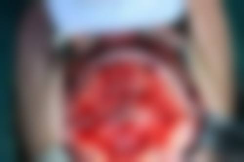 总结：让专精与优惠伴您重获健康笑容