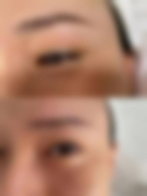 八、柳州博爱医院医疗美容科真实的患者评价