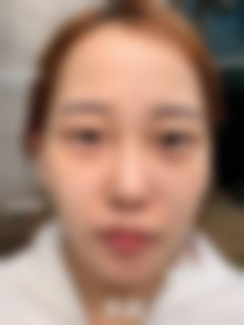 四、福州菠萝一美医疗美容诊所特色项目