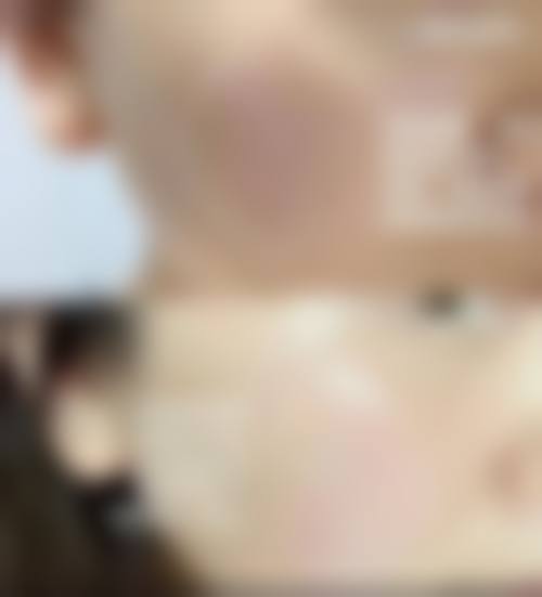二、福州菠萝一美医疗美容诊所怎么样?