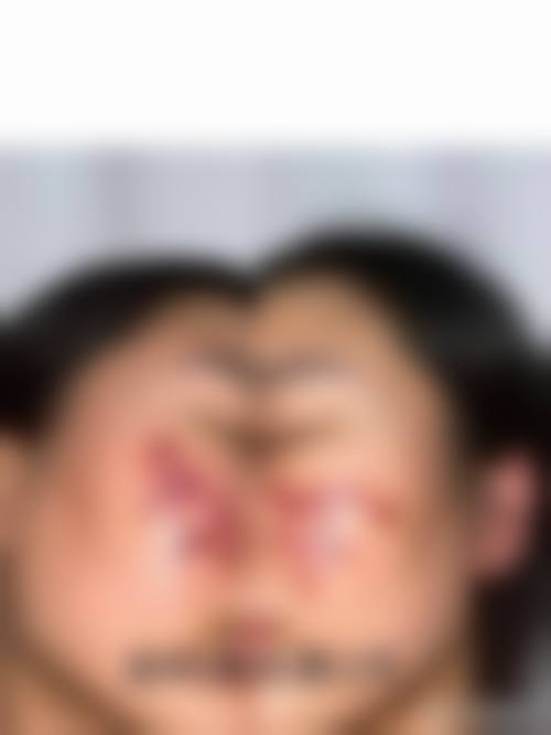 五、福州菠萝一美医疗美容诊所价格表