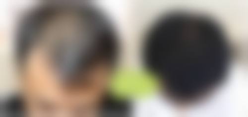 九、西宁澳丽医疗整形美容医院真实的患者评价