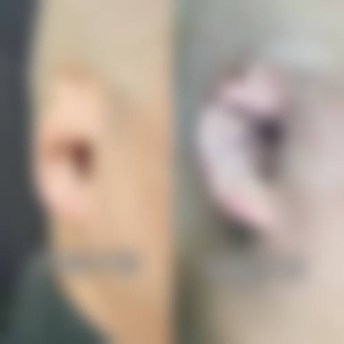 当前优惠活动详情