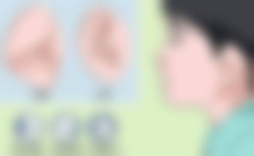 二、光电疗法——高新科技助力祛疤