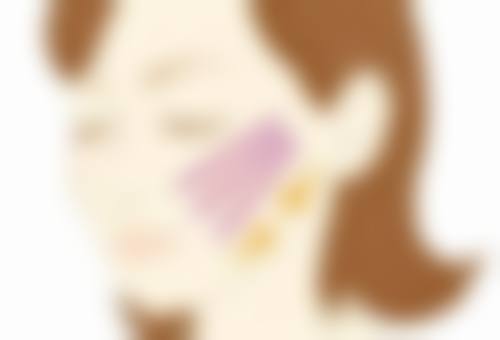 四、割双眼皮加开眼角多久修复?做好护理修复更快