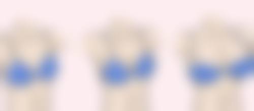 三、理疗——缓解疤痕增生的有效手段