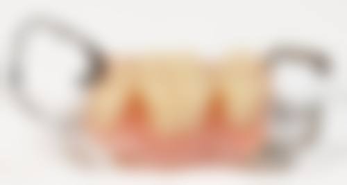 临床实例分享