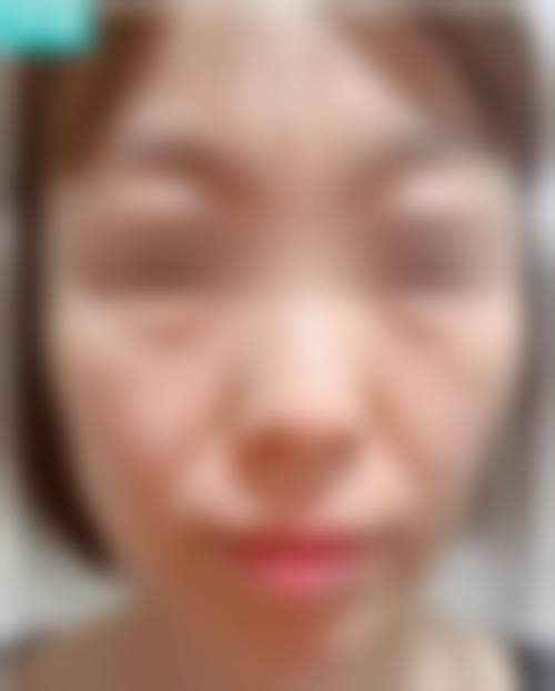 二、云南百媚医疗美容诊所怎么样?