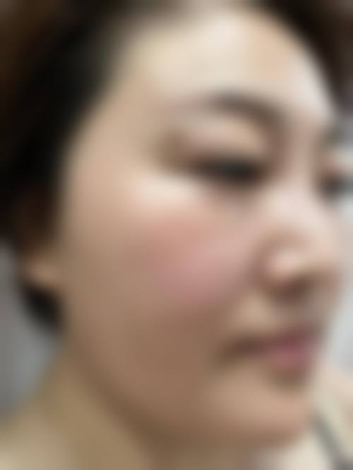八、青岛华颜美医疗整形医院真实的患者评价