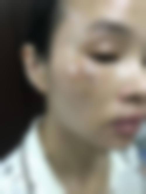 三、潍坊市市立医院腋臭整形科诊疗项目有哪些?