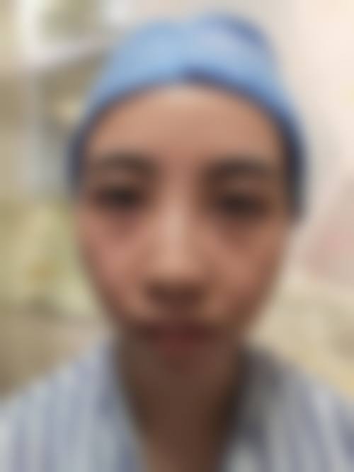 八、宿迁市叶子医疗美容门诊部真实的患者评价