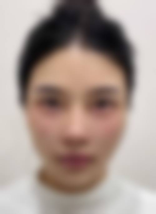 七、西安微之光医疗美容诊所预约方式