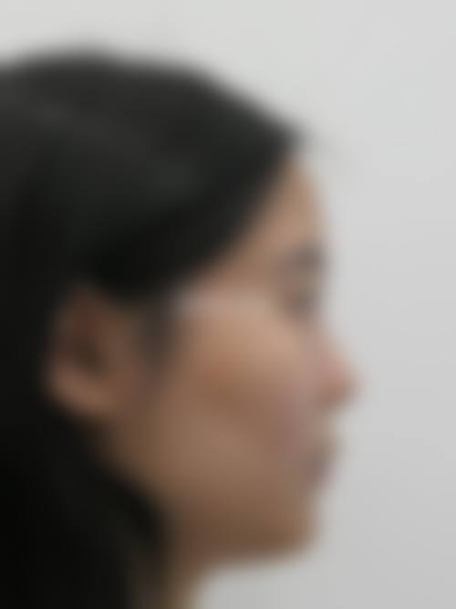 二、宿迁市叶子医疗美容门诊部怎么样?