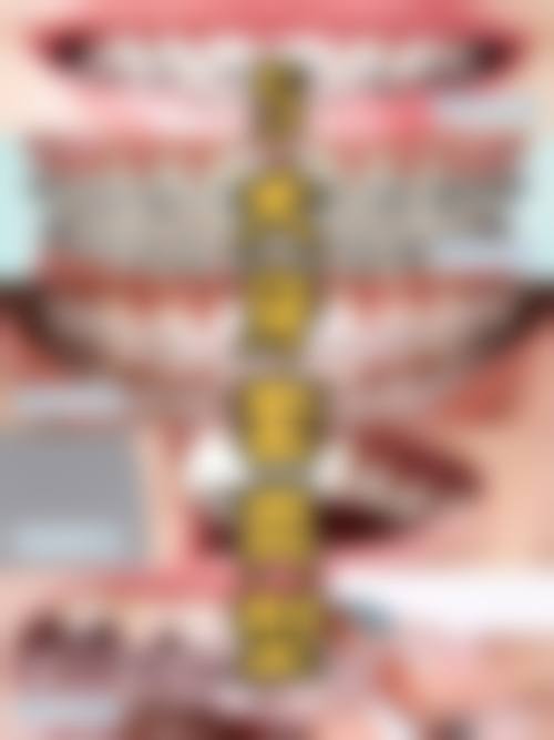 预约优惠活动