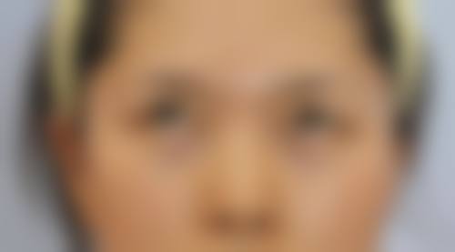 患者真实评价