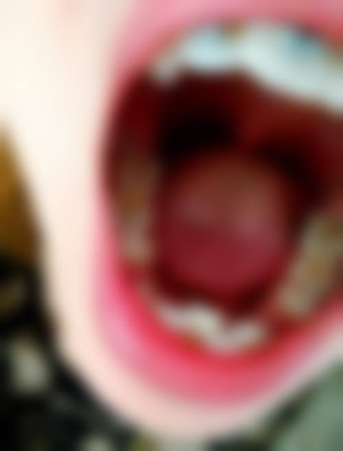 优惠活动详情