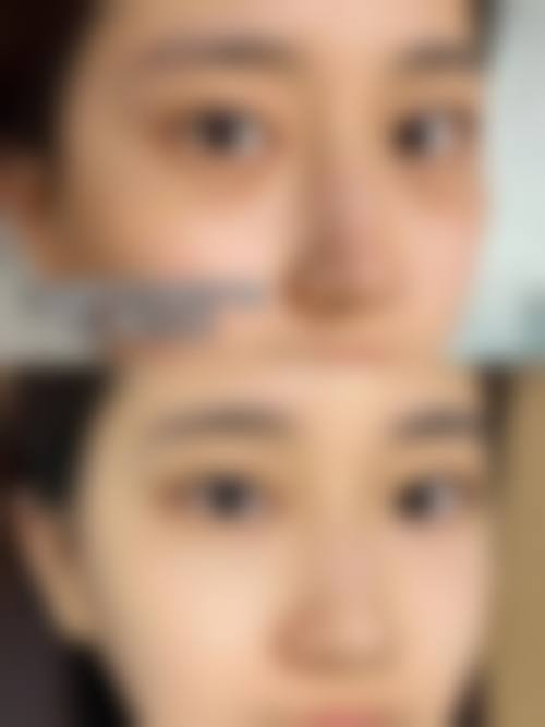九、广水美星整形医院真实的患者评价