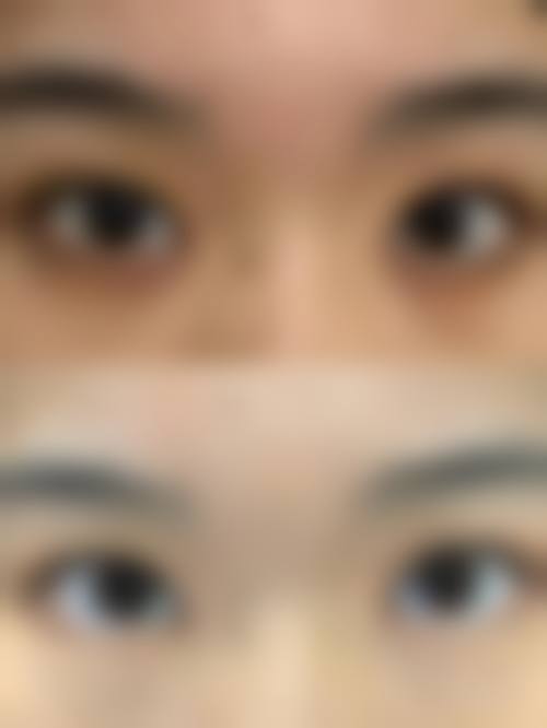 临床实例分享