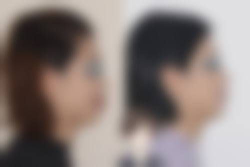 擅长项目详解