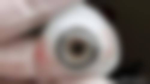 擅长项目详解：窦晓燕核心手术项目