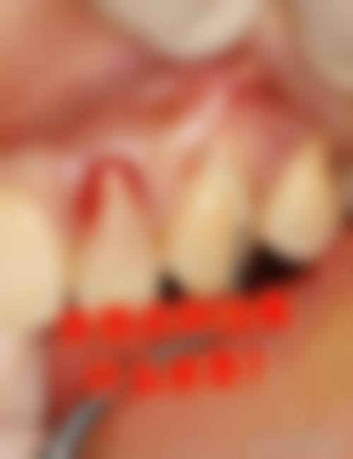 结尾预约号召