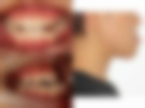 深圳菲尔齿科资质与实力怎么样?