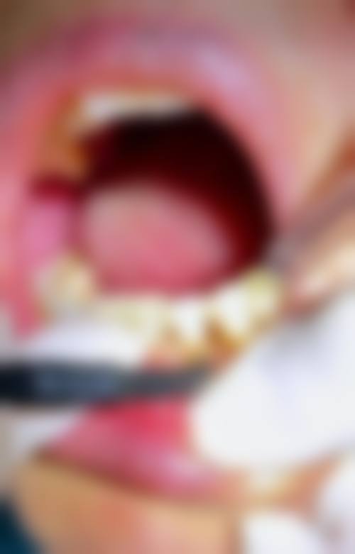 临床实例分享