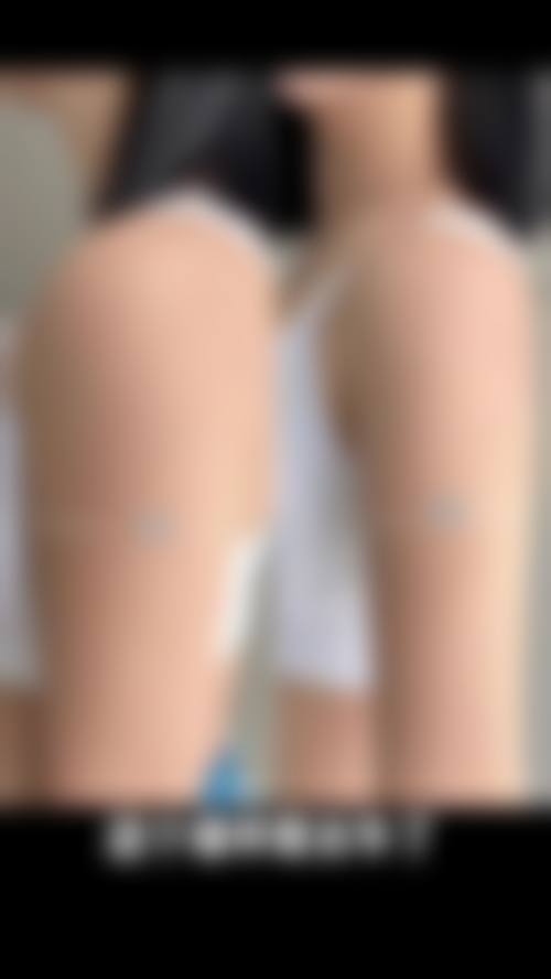 九、荆州迪亚罗兰医疗美容门诊部真实的患者评价