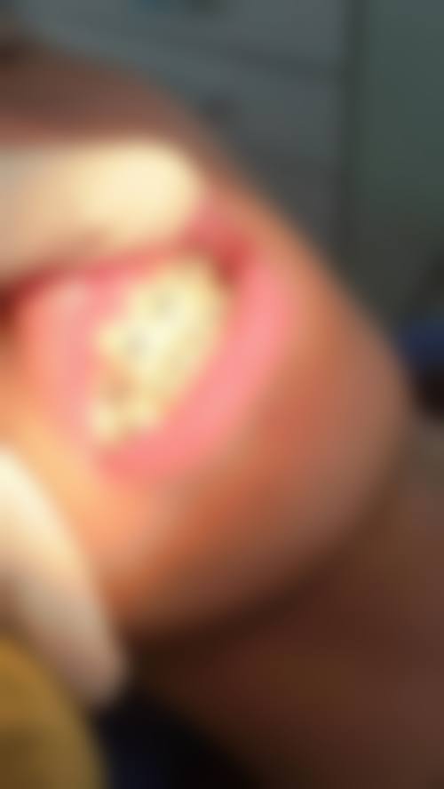 深圳菲尔齿科特色项目与技术优势