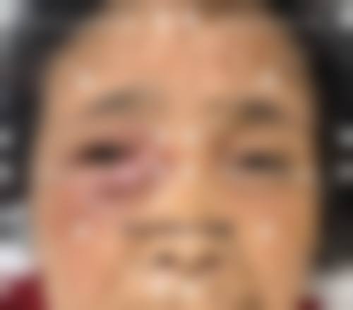 结尾:选择专精,守护清晰视界