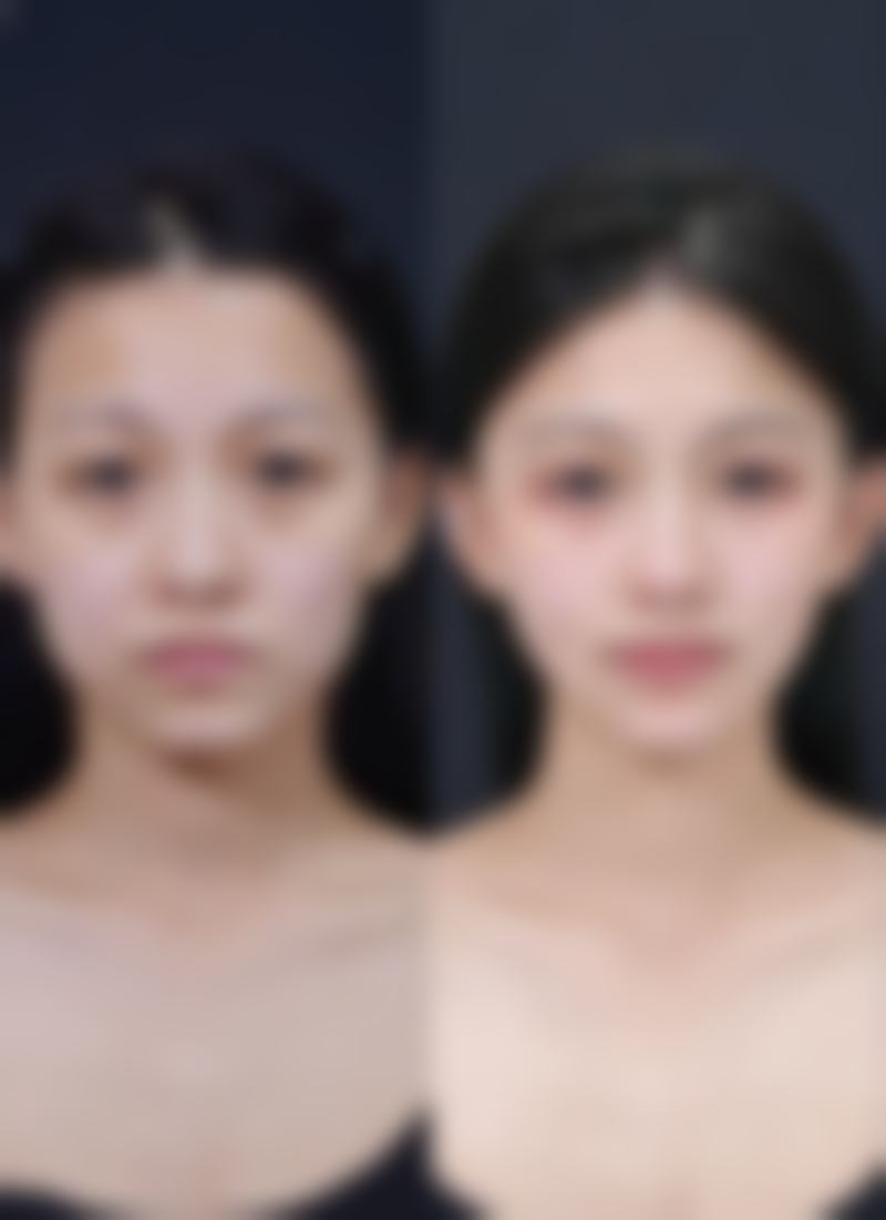 设备环境介绍：数字化设备+温馨病房