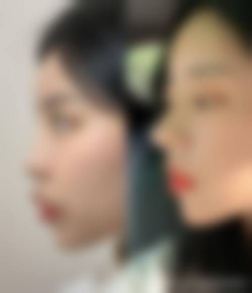 三、亓发芝技术优势