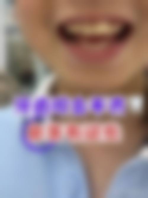 预约优惠活动