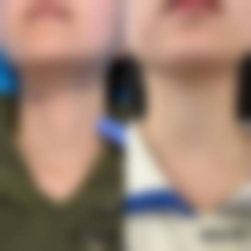 临床实例分享