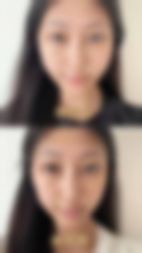 九、昆明盘龙区人民医院整形美容科真实的患者评价
