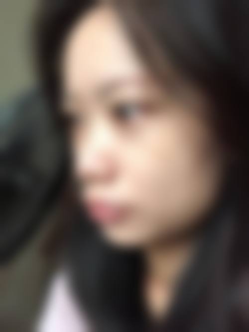 临床实例分享