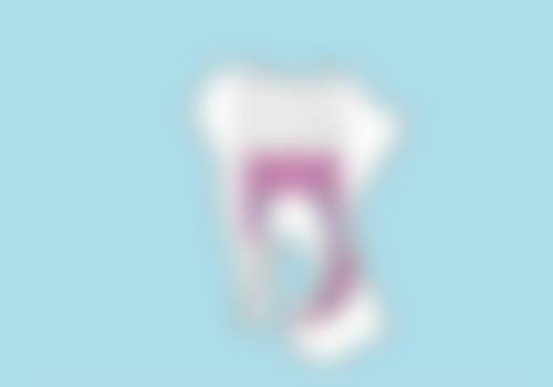 临床实例分享