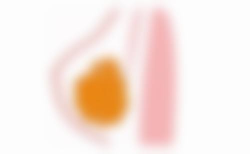 六、日常注意事项辅助去除熬夜黑眼圈眼袋