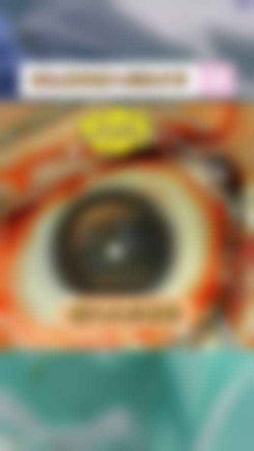 临床实例分享:龚莉华 上海爱尔新嘉眼科医院(嘉定分院) 屈光不正