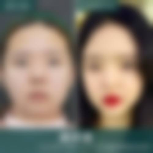 八、江苏常州柏美医疗美容门诊部（轻医美）真实的患者评价