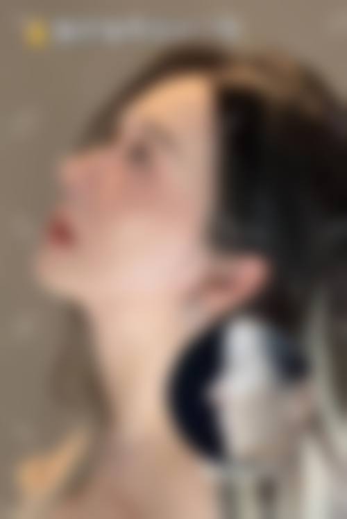 临床实例分享