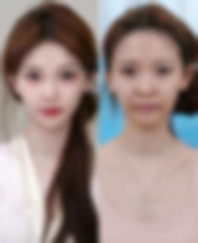 六、雷曼苹真实的患者评价