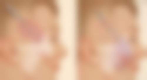 五、沈阳亿美医疗美容医院价格表